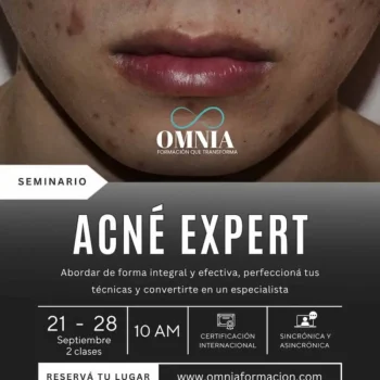 ACNÉ EXPERT - 21 y 28 de Septiembre