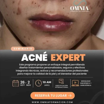 ACNÉ EXPERT - 26/oct y 2/nov (10 AM)