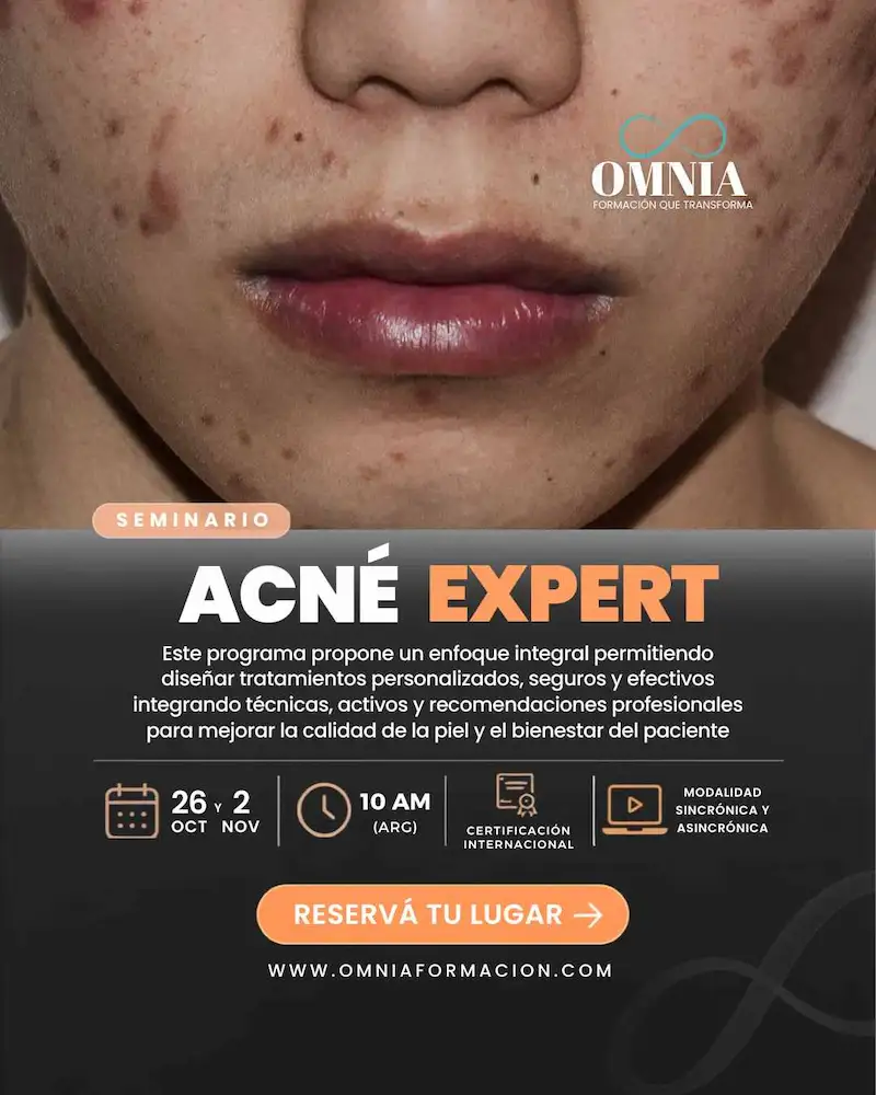 ACNÉ EXPERT - 26/oct y 2/nov (10 AM)