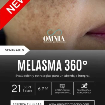 MELASMA 360 - 21 de Septiembre